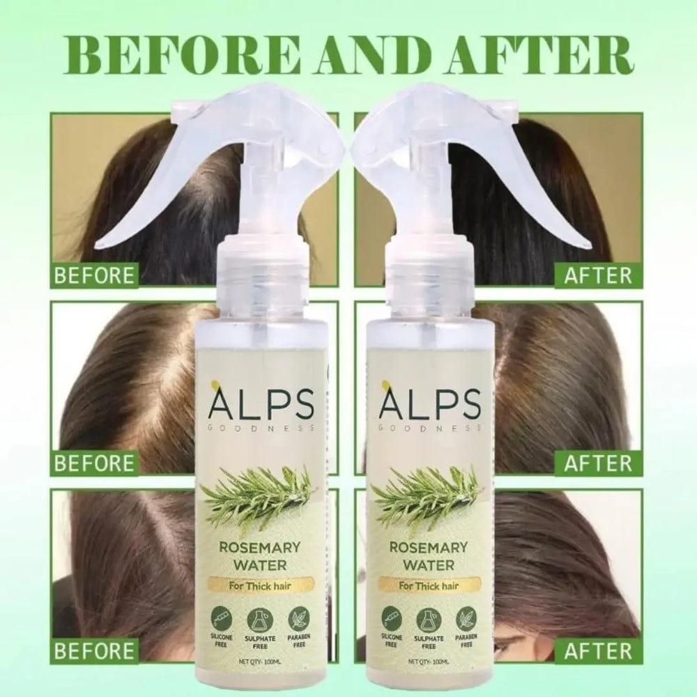 Rosemary Hair Regrowth Spray – Pack of 3 (100ml Each)