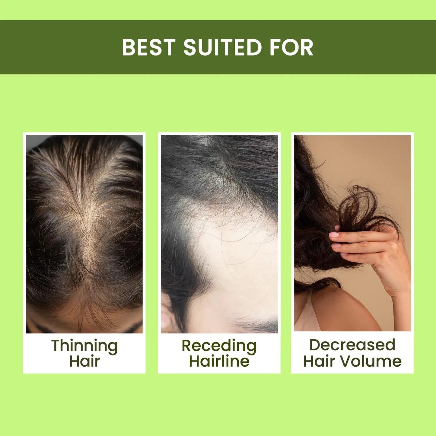 Rosemary Hair Regrowth Spray – Pack of 3 (100ml Each)